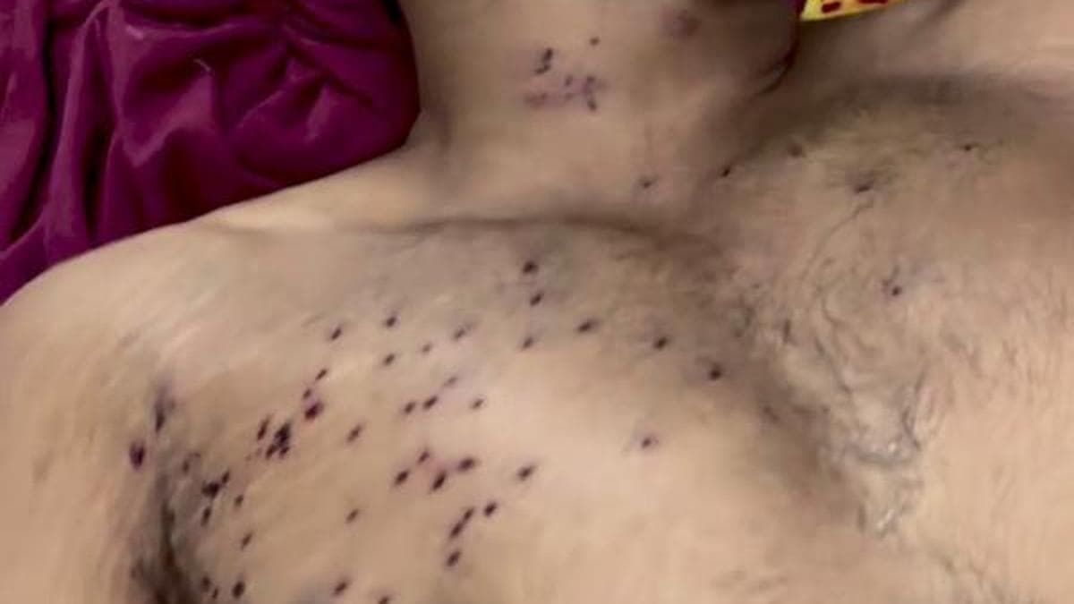 Are pellet guns legal for crowd control in India?